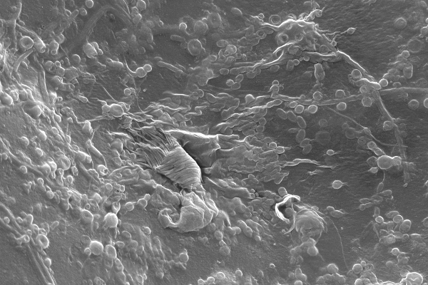 Bei der Frage: Was ist Aquaponik? haben fleißige Mikroben als Kläranlage im Urban Farming die Schlüsselfunktion schlechthin..